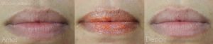 Esfoliante Labial Sugar Sugar Koloss